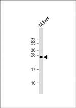 IGF2 Antibody in Western Blot (WB)