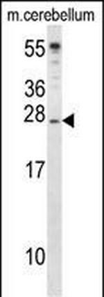 IGF2 Antibody in Western Blot (WB)