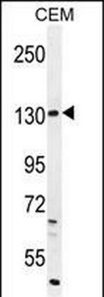 DUOX2 Antibody in Western Blot (WB)