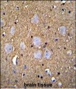 CAMSAP1 Antibody in Immunohistochemistry (Paraffin) (IHC (P))