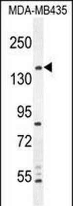 CAMSAP1 Antibody in Western Blot (WB)