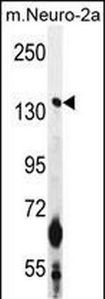 CAMSAP1 Antibody in Western Blot (WB)