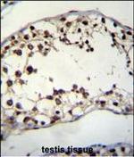 PIH1D2 Antibody in Immunohistochemistry (Paraffin) (IHC (P))