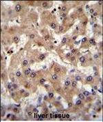 PRAMEF6 Antibody in Immunohistochemistry (Paraffin) (IHC (P))