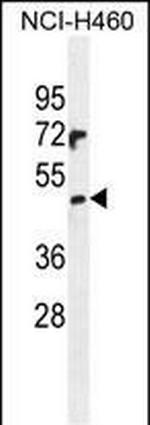 PRAMEF6 Antibody in Western Blot (WB)