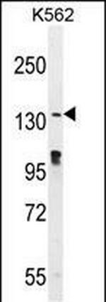 OVOS2 Antibody in Western Blot (WB)