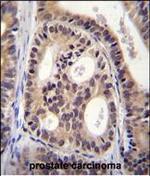 SPECC1L Antibody in Immunohistochemistry (Paraffin) (IHC (P))