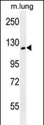 SPECC1L Antibody in Western Blot (WB)