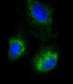 SFTPC Antibody in Immunocytochemistry (ICC/IF)