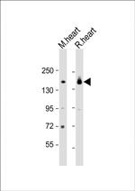 MYBPC3 Antibody in Western Blot (WB)