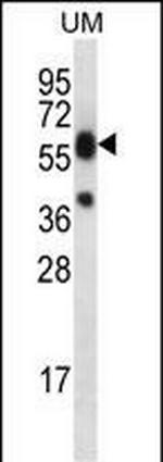 LIPM Antibody in Western Blot (WB)