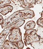 GAA Antibody in Immunohistochemistry (Paraffin) (IHC (P))