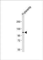 GAA Antibody in Western Blot (WB)