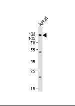 GAA Antibody in Western Blot (WB)