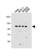 GAA Antibody in Western Blot (WB)