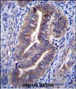 KIAA1324 Antibody in Immunohistochemistry (Paraffin) (IHC (P))