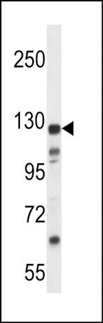 KIAA1324 Antibody in Western Blot (WB)