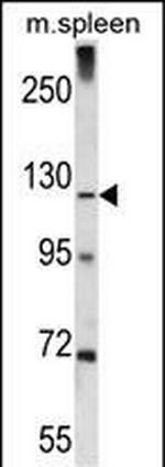 KIAA1324 Antibody in Western Blot (WB)