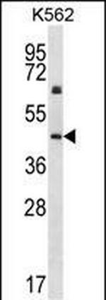 Cytokeratin 12 Antibody in Western Blot (WB)