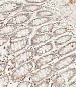 SFRP5 Antibody in Immunohistochemistry (Paraffin) (IHC (P))