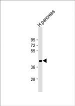 SFRP5 Antibody in Western Blot (WB)