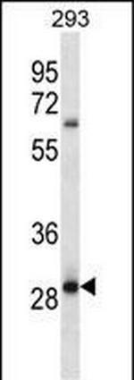 MRAP2 Antibody in Western Blot (WB)