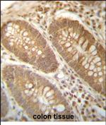 PGAM4 Antibody in Immunohistochemistry (Paraffin) (IHC (P))