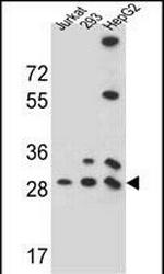 PGAM4 Antibody in Western Blot (WB)