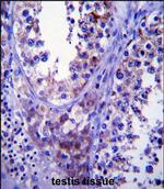 SDF2L1 Antibody in Immunohistochemistry (Paraffin) (IHC (P))