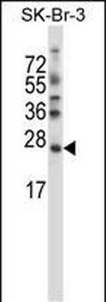 SDF2L1 Antibody in Western Blot (WB)