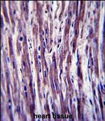 HACD1 Antibody in Immunohistochemistry (Paraffin) (IHC (P))