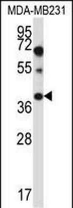 HACD1 Antibody in Western Blot (WB)