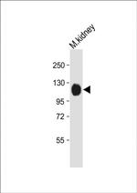 NPR1 Antibody in Western Blot (WB)