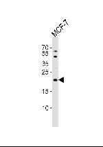 TIMM23 Antibody in Western Blot (WB)