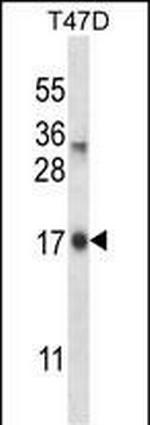 IGF2-AS Antibody in Western Blot (WB)