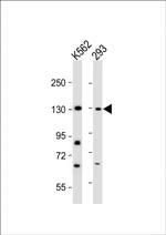 Rubicon Antibody in Western Blot (WB)