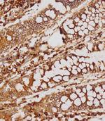 GATSL2 Antibody in Immunohistochemistry (Paraffin) (IHC (P))