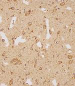 GATSL2 Antibody in Immunohistochemistry (Paraffin) (IHC (P))