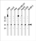 GATSL2 Antibody in Western Blot (WB)