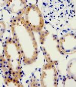 alpha-1D Adrenoceptor Antibody in Immunohistochemistry (Paraffin) (IHC (P))