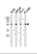 alpha-1D Adrenoceptor Antibody in Western Blot (WB)