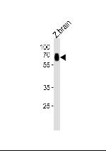 SLC17A6A Antibody in Western Blot (WB)