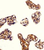 DLK1 Antibody in Immunohistochemistry (Paraffin) (IHC (P))