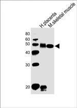 DLK1 Antibody in Western Blot (WB)