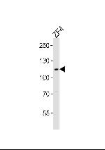 SH3BP4A Antibody in Western Blot (WB)