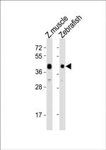 ADRA2DB Antibody in Western Blot (WB)