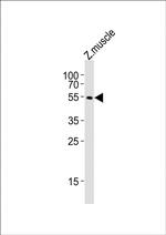 alpha-2a Adrenergic Receptor Antibody in Western Blot (WB)