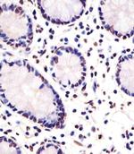 FEV Antibody in Immunohistochemistry (Paraffin) (IHC (P))