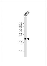 FEV Antibody in Western Blot (WB)