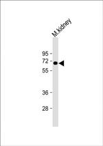 MGAT4A Antibody in Western Blot (WB)